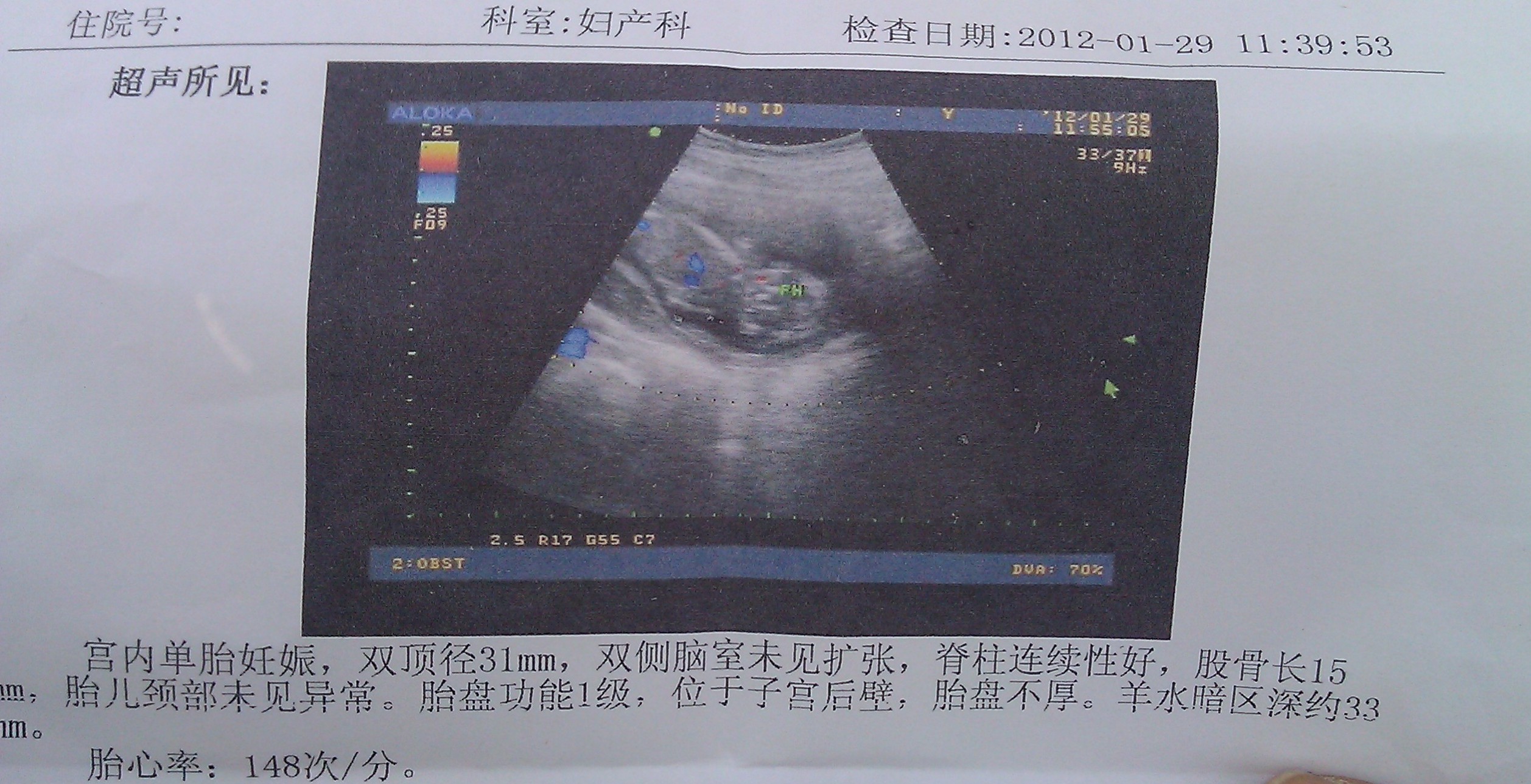 老婆怀孕14周，子宫内除胎儿还有一液性暗区 去医院检查医生也说不出个所以然来 现附上今天彩超报告单 - 百度宝宝知道