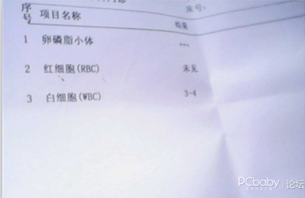 晒一晒老公前列腺炎,早泄的的治愈过程 附报告