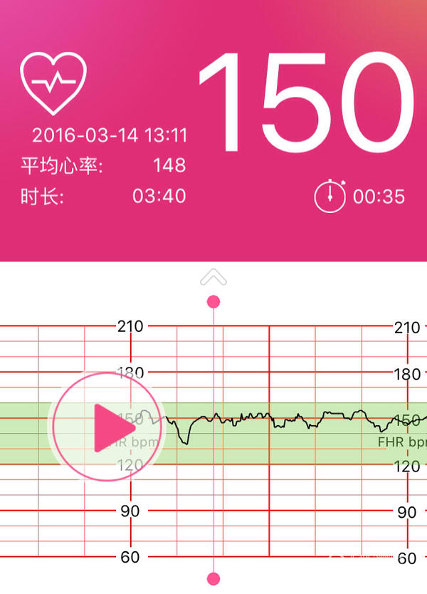 明天34周了,都说孕晚期胎动会减少,可是