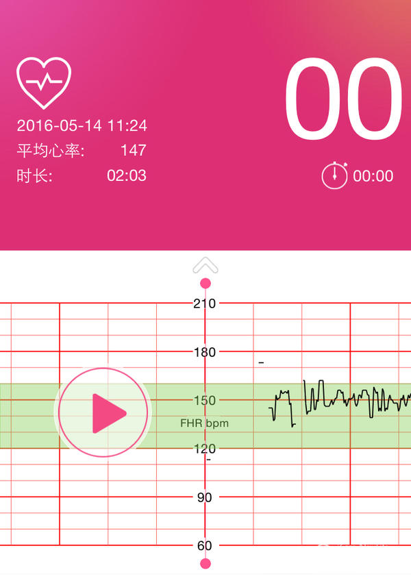 您好,请问孩子心脏有早搏和心律不齐吗?上_快