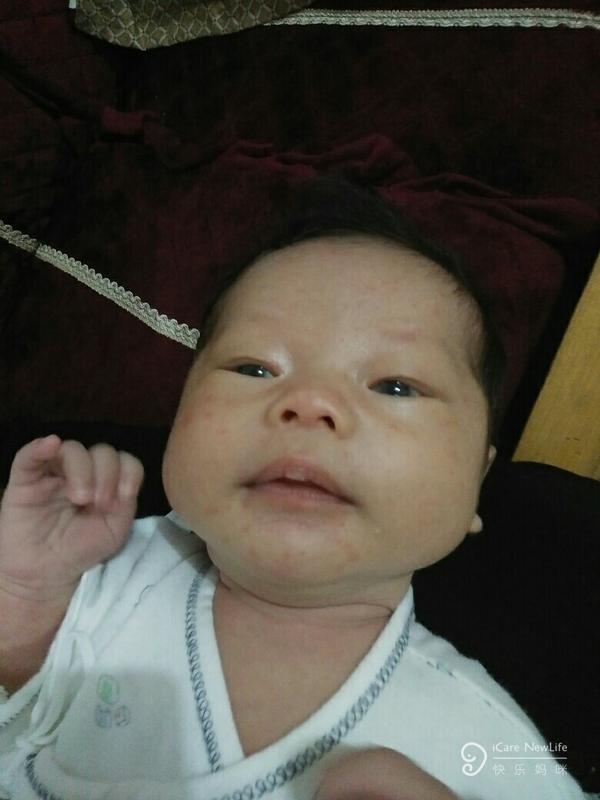 林医生,我的宝宝出生23天,脸上长了好多红点,满
