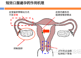 毓婷的避孕原理是什么_避孕栓是什么样子图片