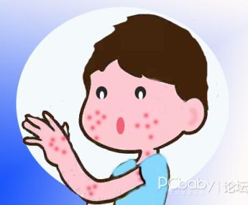 各个年龄段的湿疹是什么样的?
