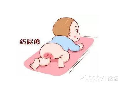 婴儿尿布疹怎么办答案就在这里