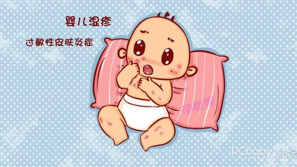 宝宝湿疹的原因是什么婴儿湿疹多久能够自愈