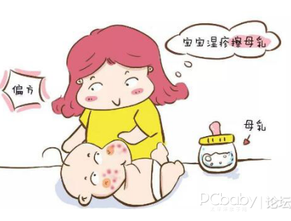 新生婴儿湿疹用母乳擦管用吗,婴儿湿疹湿疹妙招