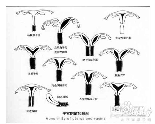 关于输卵管造影的利弊?