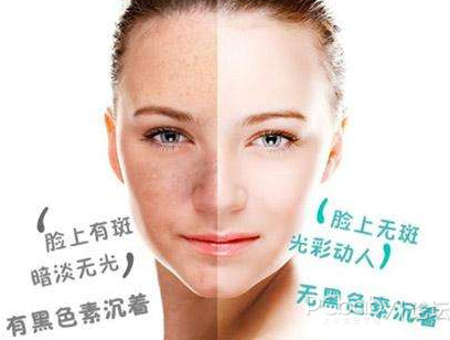 怎样有效去除黄褐斑 59092426_1505295559898_1024x1024.png