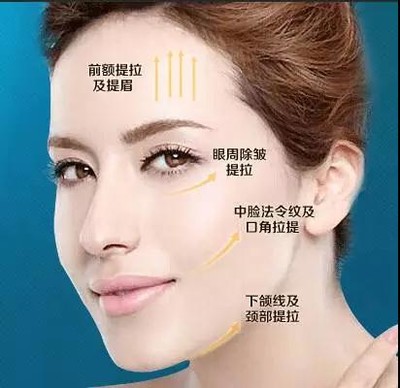 线雕后脸上有坑怎么办?做完线雕注意事项?