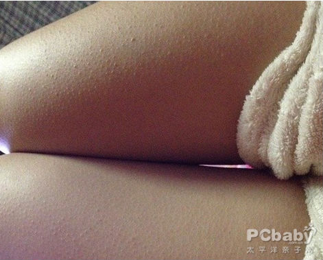 怎么样才可以不长鸡皮疙瘩 127554146_1547001619138_650x650.jpg